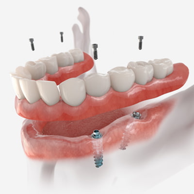 ortodontik tedavi