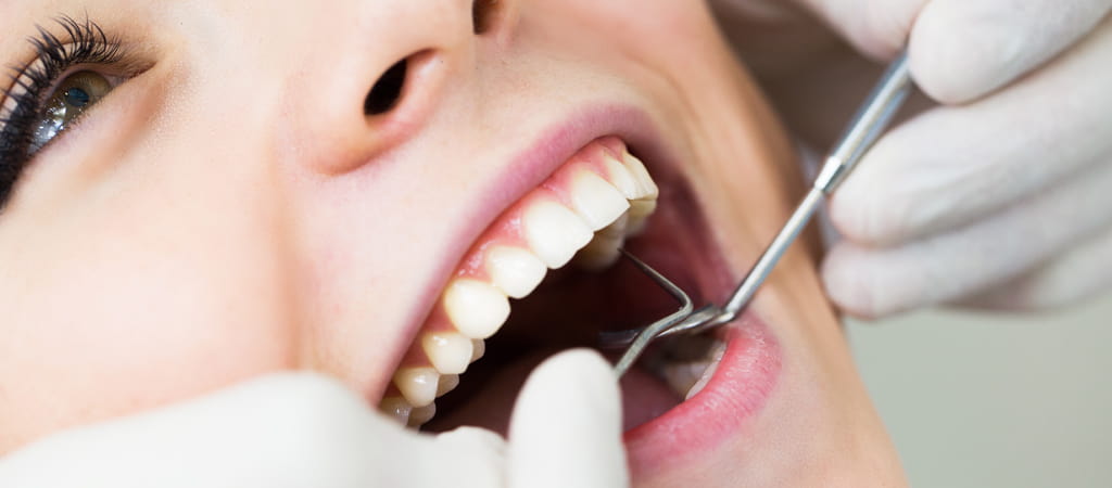 Dental filling