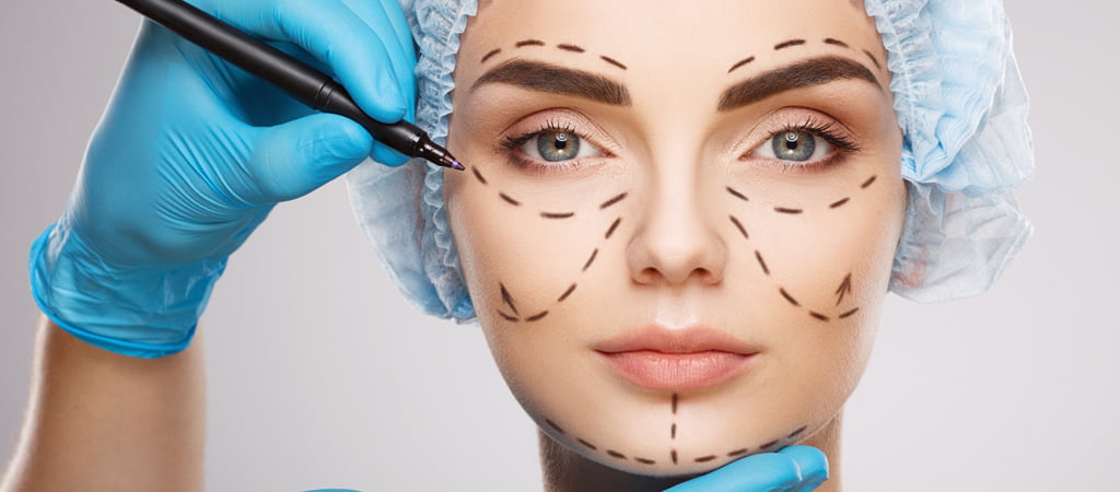 What is a Face Lift (Rhytidectomy)?